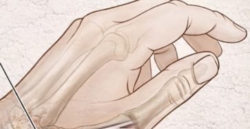 Screenshot 20260310 215428 Brave 363x188